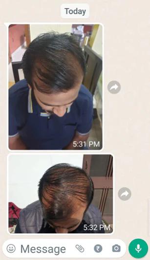 KARNATAKA ADIVASI HAIR OIL ALL VARIENTS